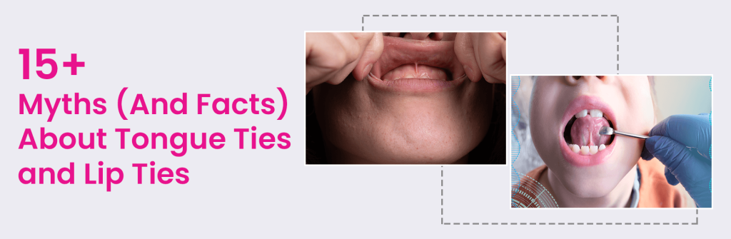 15+ Myths (And Facts) About Tongue Ties And Lip Ties | | TMJ, Tongue Tie & Sleep Institute – Tongue Tie Treatment in Mumbai, India | Tongue Tie |