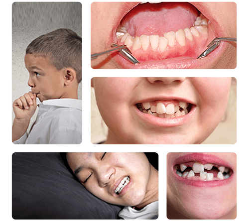 What Is The Correct Age For A Child To Get Braces? | | TMJ, Tongue Tie & Sleep Institute – Tongue Tie Treatment in Mumbai, India | Myofunctional therapy |