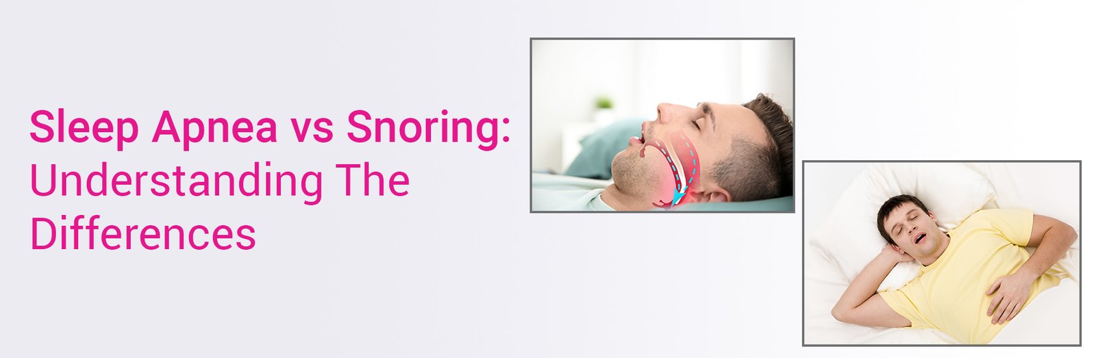 Sleep Apnea Vs Snoring: Understanding the Differences