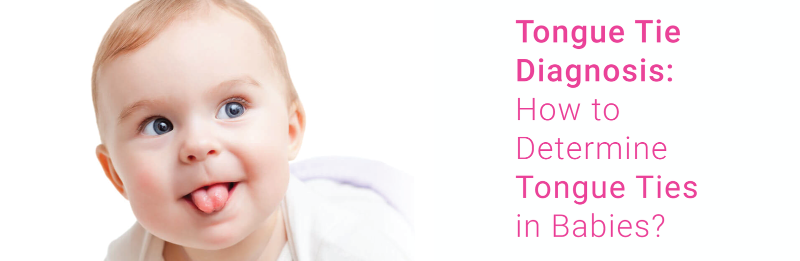 Tongue Tie Diagnosis: How To Determine Tongue Ties In Babies?