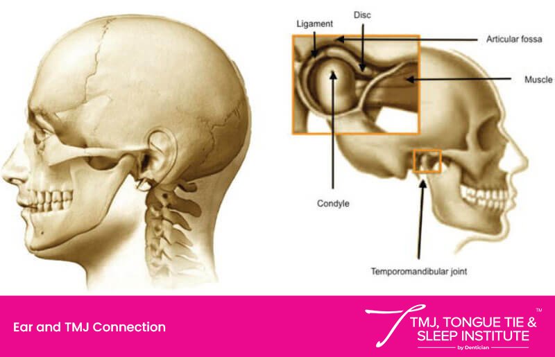 Is It Ear Pain Or Tmd? | | TMJ, Tongue Tie & Sleep Institute – Tongue Tie Treatment in Mumbai, India | TMJ |