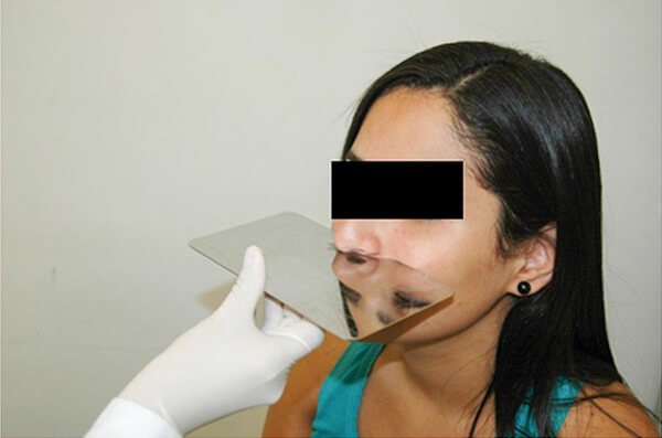 3 Methods To Test If Your Child Is Habitually Mouth Breathing | | TMJ, Tongue Tie & Sleep Institute – Tongue Tie Treatment in Mumbai, India | Myofunctional therapy |