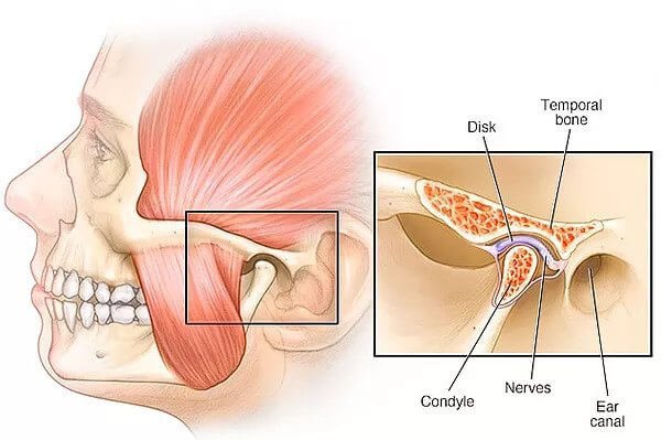 How to Cure TMJ Permanently? | | TMJ, Tongue Tie & Sleep Institute – Tongue Tie Treatment in Mumbai, India | TMJ |