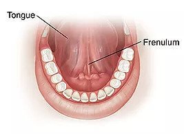 Children | | TMJ, Tongue Tie & Sleep Institute – Tongue Tie Treatment in Mumbai, India | |