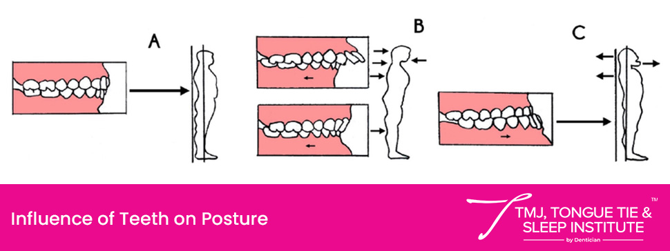 How to Cure TMJ Permanently? | | TMJ, Tongue Tie & Sleep Institute – Tongue Tie Treatment in Mumbai, India | TMJ |