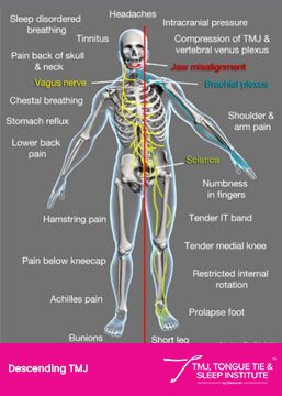 TMJ/TMD | | TMJ, Tongue Tie & Sleep Institute – Tongue Tie Treatment in Mumbai, India | |